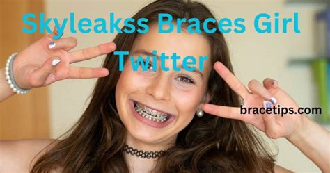 skyleakss braces girl|@skyleakks 